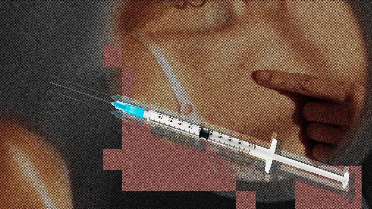 Vacuna personalizada contra el melanoma reduce recurrencia
