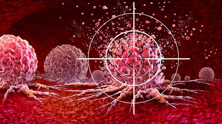 Pacientes con cáncer viajan a China: tratamientos de avanzada y menores costos impulsan la búsqueda de una oportunidad