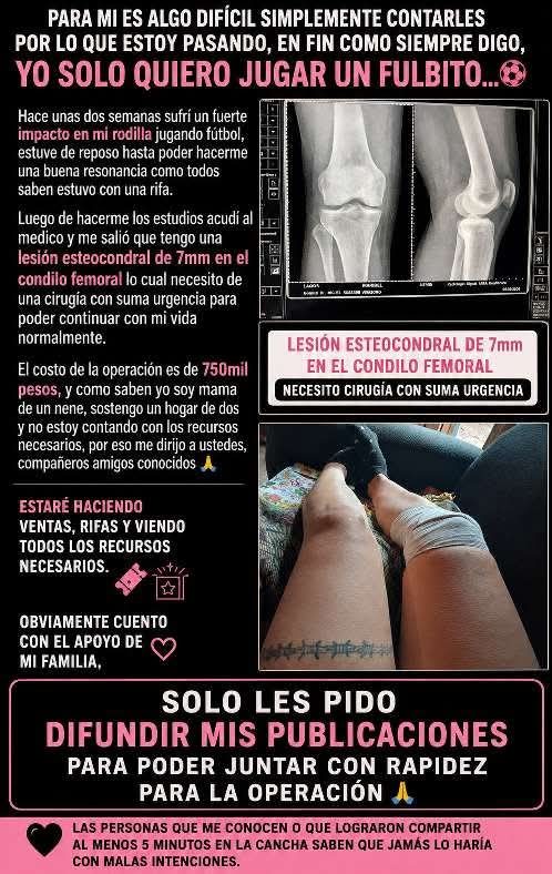 Organizan rifa solidaria para costear una cirugía
