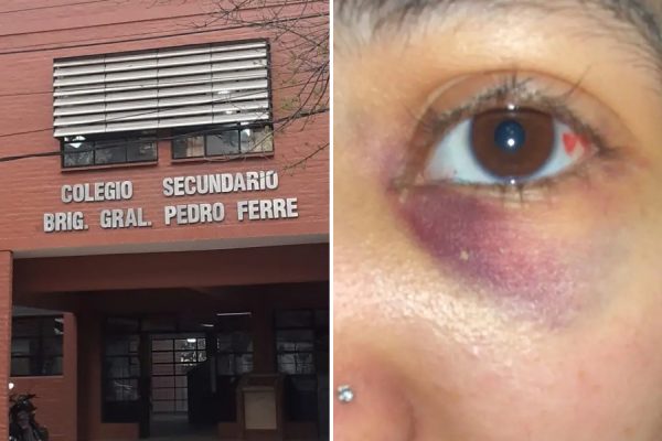Golpiza a una alumna en Corrientes: necesita cirugía de $6 millones