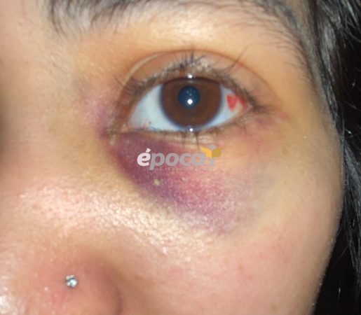 Corrientes: denuncian que una alumna le fracturó la cara a otra