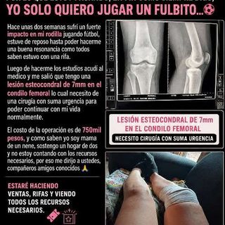 Organizan rifa solidaria para costear una cirugía
