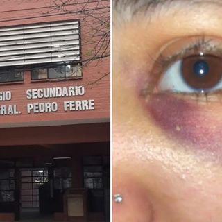 Golpiza a una alumna en Corrientes: necesita cirugía de $6 millones