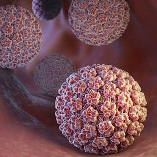 La OMS alertó sobre el avance del cáncer y advirtió por un preocupante dato de Argentina