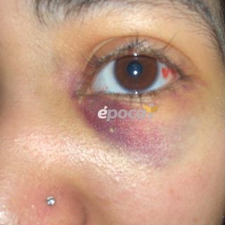 Corrientes: denuncian que una alumna le fracturó la cara a otra