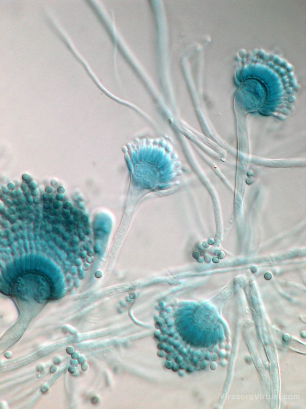Identifican incidencia de una micosis pulmonar en 10% de pacientes críticos con COVID