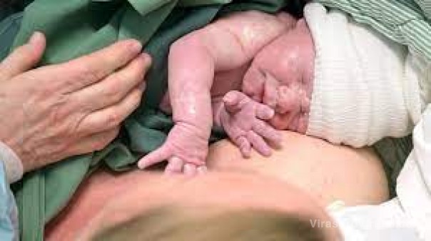 Aumentó la cantidad de partos por cesáreas en Corrientes: son 1 de cada 4 nacimientos