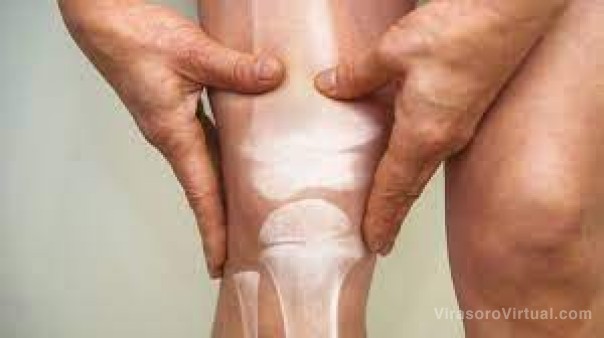 Osteoporosis: cinco pasos para tener huesos sanos