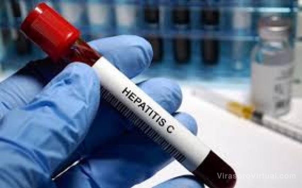 Hepatitis: Salud insta a estar atentos a síntomas compatibles