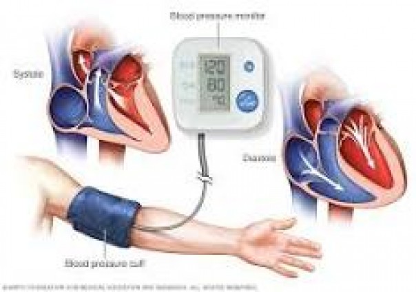 Salud realizará actividades por el Día Mundial de la Hipertensión Arterial